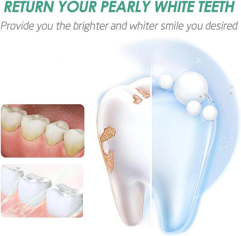 Eelhoe Teeth Whitening Mouth Spray – Portable Oral Care Spray 30ml