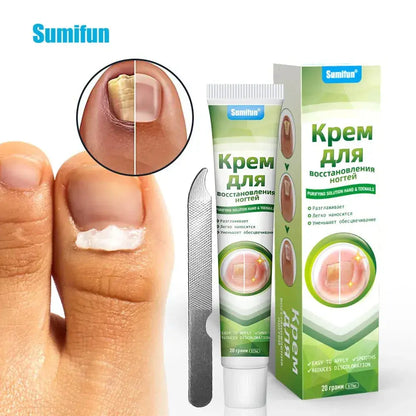 🔥Sumifun Nail Treatment Repair Gel 20g – Nail Repair Cream for Damaged, Brittle & Discolored Fingernails and Toenails