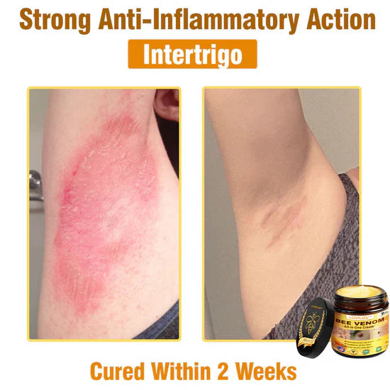 South Moon Bee Venom Pain Relief Cream for Arthritis, Muscle & Joint Discomfort (Original) - StylesNest Arabia