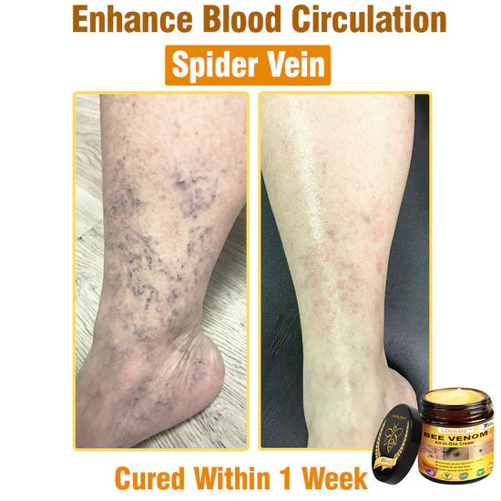 South Moon Bee Venom Pain Relief Cream for Arthritis, Muscle & Joint Discomfort (Original) - StylesNest Arabia