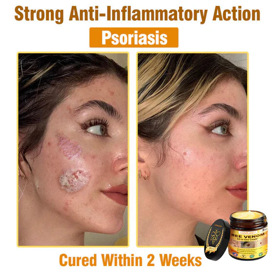South Moon Bee Venom Pain Relief Cream for Arthritis, Muscle & Joint Discomfort (Original) - StylesNest Arabia