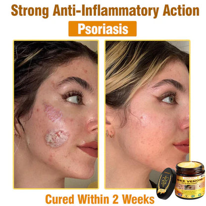 South Moon Bee Venom Pain Relief Cream for Arthritis, Muscle & Joint Discomfort (Original) - StylesNest Arabia