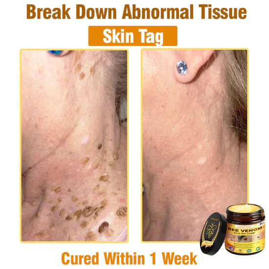 South Moon Bee Venom Pain Relief Cream for Arthritis, Muscle & Joint Discomfort (Original) - StylesNest Arabia
