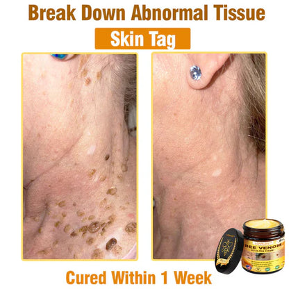 South Moon Bee Venom Pain Relief Cream for Arthritis, Muscle & Joint Discomfort (Original) - StylesNest Arabia