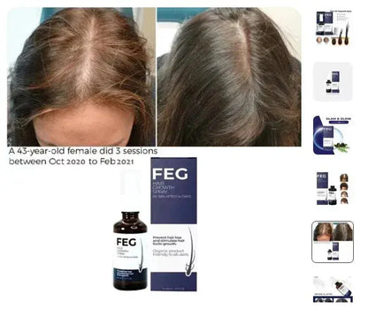 FEG Hair Growth Spray 50ml – Herbal Hair & Scalp Nourishing Spray for Stronger, Healthier Looking Hair