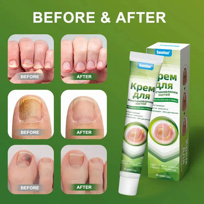 🔥Sumifun Nail Treatment Repair Gel 20g – Nail Repair Cream for Damaged, Brittle & Discolored Fingernails and Toenails