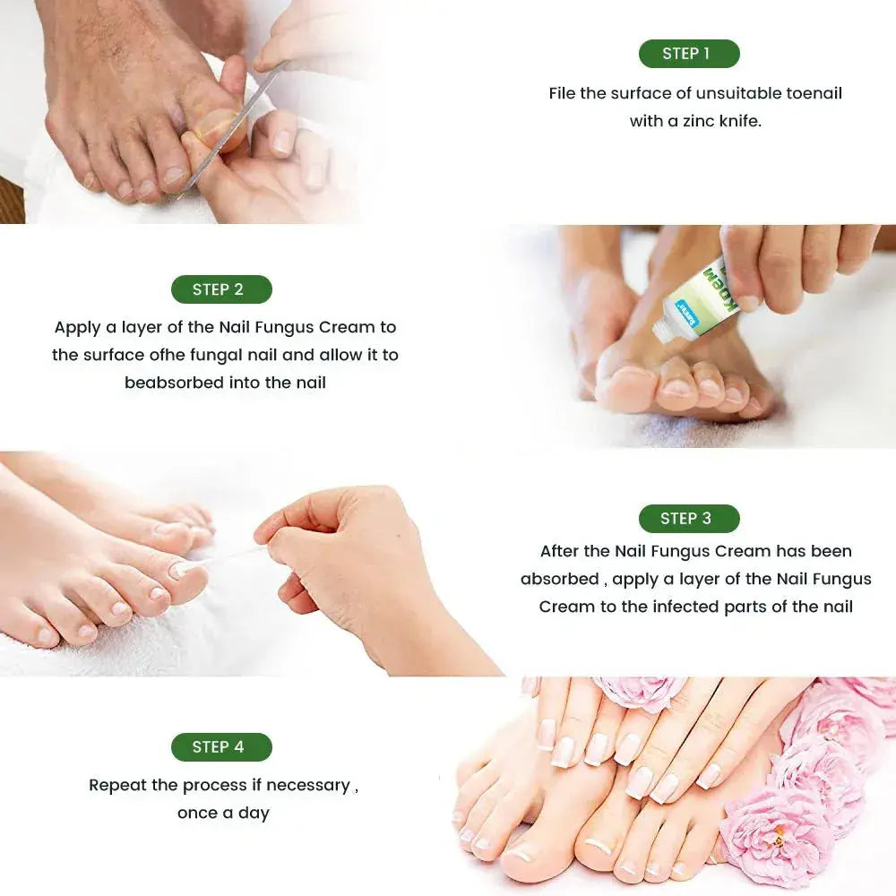 🔥Sumifun Nail Treatment Repair Gel 20g – Nail Repair Cream for Damaged, Brittle & Discolored Fingernails and Toenails