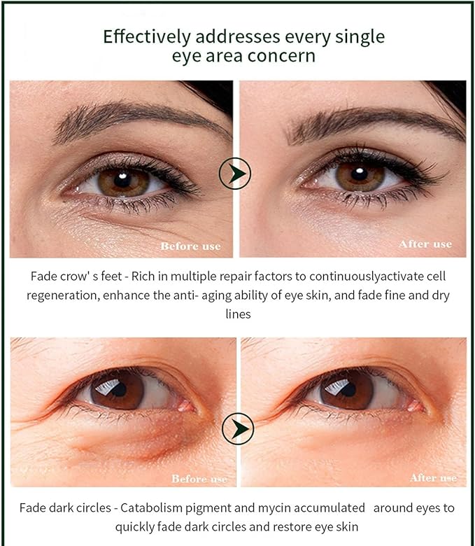 Time Eraser Eye Essence Oil 10ml – Lightweight Under-Eye Care Serum
