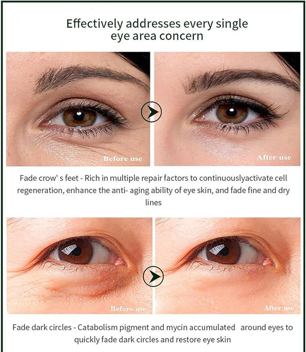 Time Eraser Eye Essence Oil 10ml – Lightweight Under-Eye Care Serum